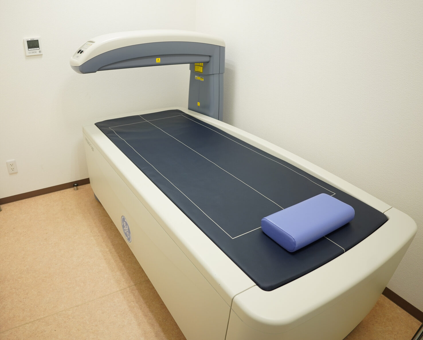 DEXA